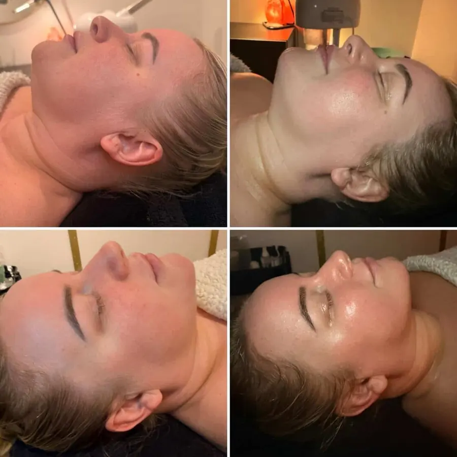 Facial and lymphatic massage results
