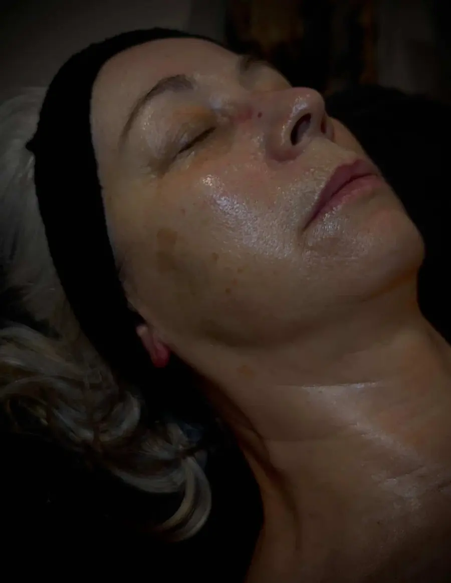 Skin after a Refresh and Plump facial